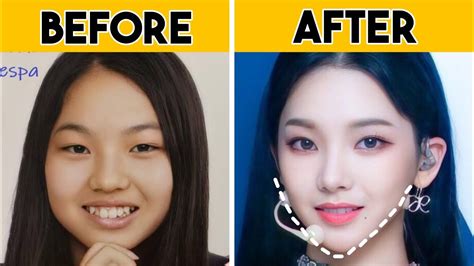 aespa plastic surgery|Dream Plastic